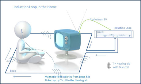 Loops for Home